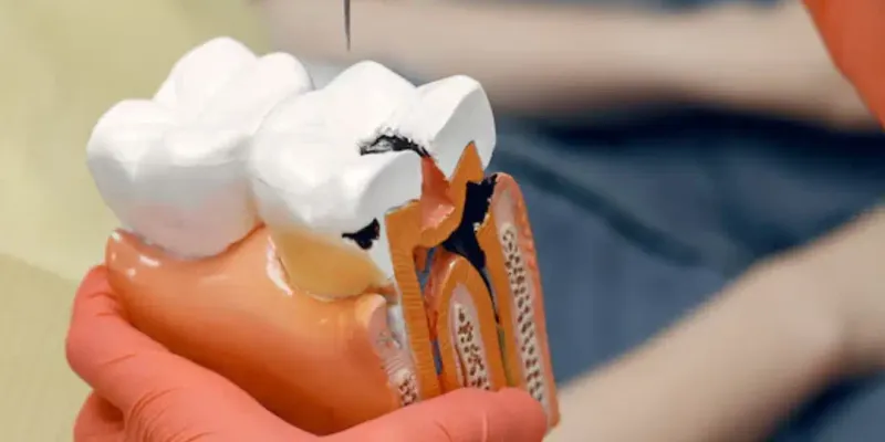 Dentista San Pedro Cholula San Andres Cholula