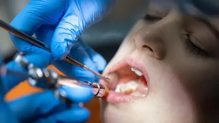 Extracción Dental