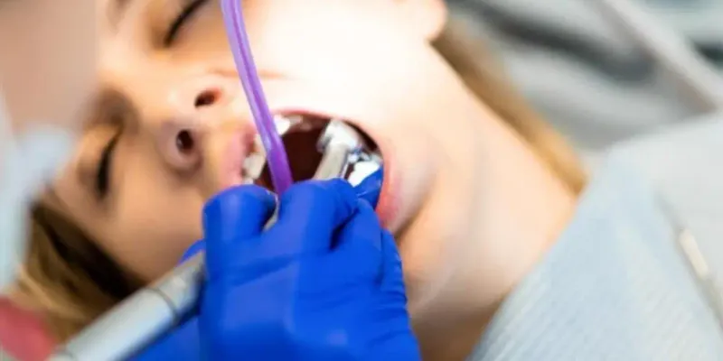 Limpieza dental y profilaxis Cholula Puebla